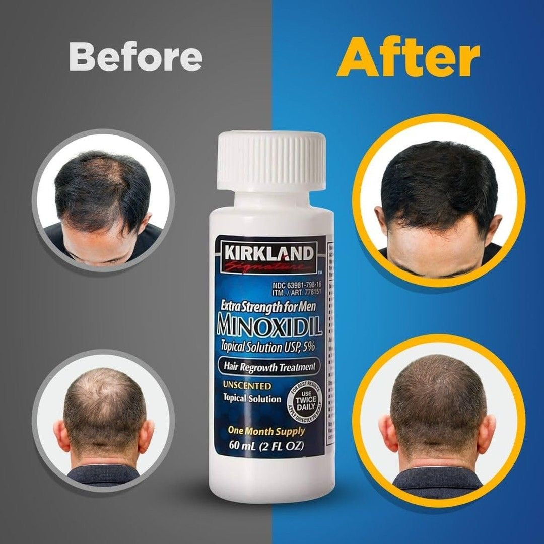Minoxidil
